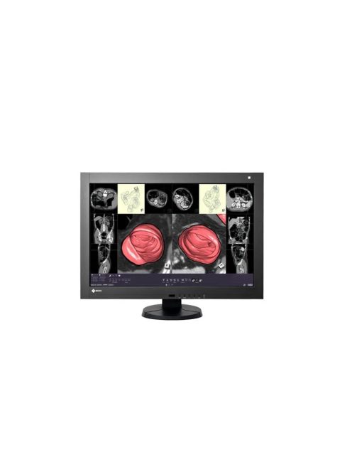 EIZO 29RadiForce RX430 / 30 inch / 2560x1600 használt monitor